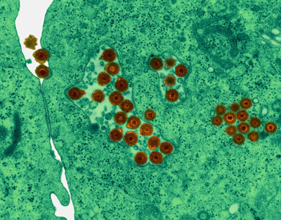 Herpes Simplex Virus, Electron Microscope Photograph Dennis Kunkel